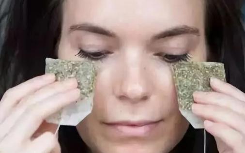 为什么会出现黑眼圈和浮肿