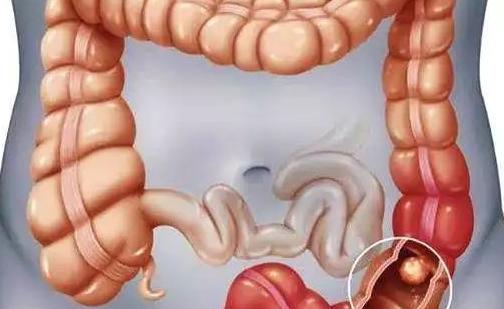 肠道不健康的 9 个迹象