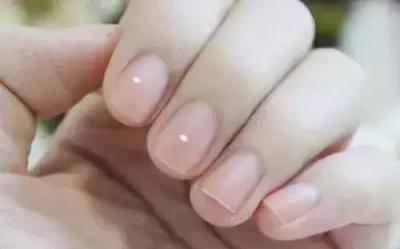 如何防止指甲上出现白斑