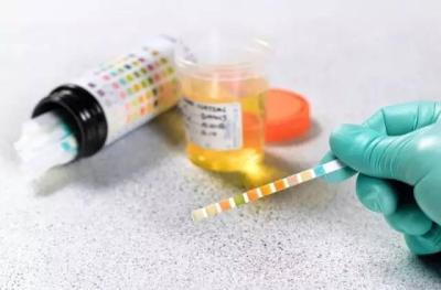 尿液闻起来很奇怪的7个理由