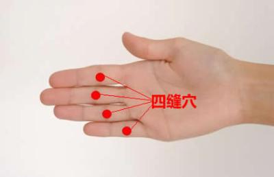 肠胃不好按摩什么穴位你知道吗?