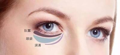有眼袋是一种病？