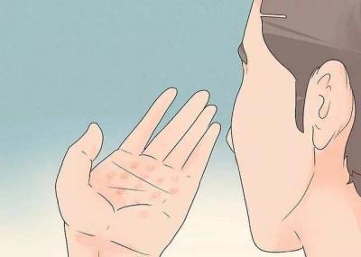 手上起水泡并且痒,怎么办?