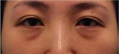 出现这些问题你需要补肾了