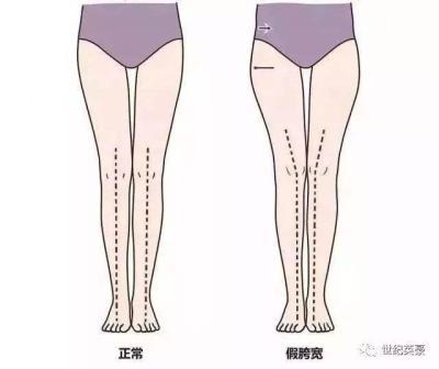 胯宽屁股大怎么减肥