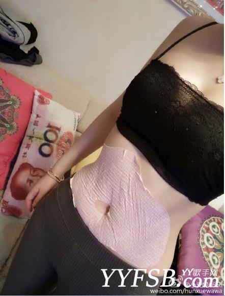 天佑VS小安妮事件 YY小安妮真的怀孕了吗？