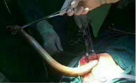 黄鳝门琪琪照片 黄鳝门女主播琪琪死了吗？