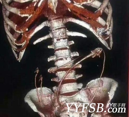 黄鳝门琪琪照片 黄鳝门女主播琪琪死了吗？