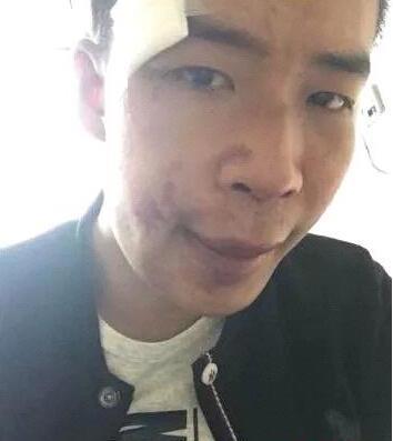 网上流传IR刘一手被打的头破血流现场图片