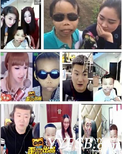 YY外星人陈山病重粉丝献血救助