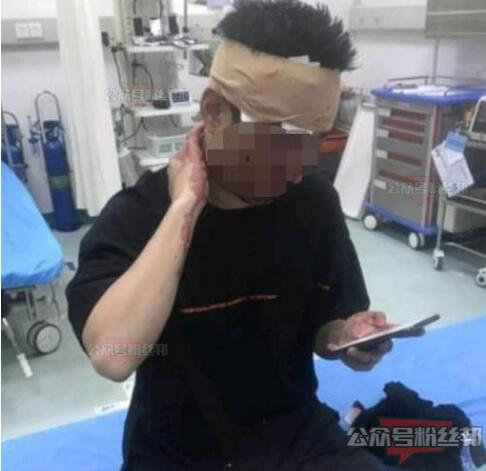 斗鱼钱小佳粉丝节被江小白爆头事件，钱小佳江小白是什么梗，事件来龙去脉
