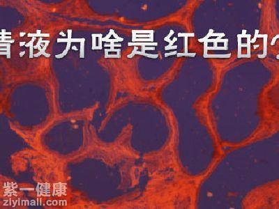 男人精液颜色变黄是怎么回事 从精液颜色看健康问题