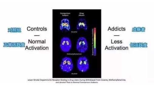 年轻人每天都想自慰会不会有影响 长期自己解决的后果