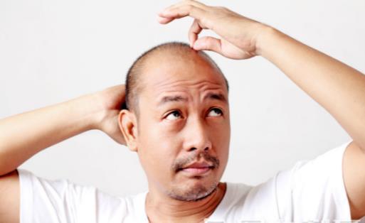 如何预防脱发？ 建议从6个方面入手