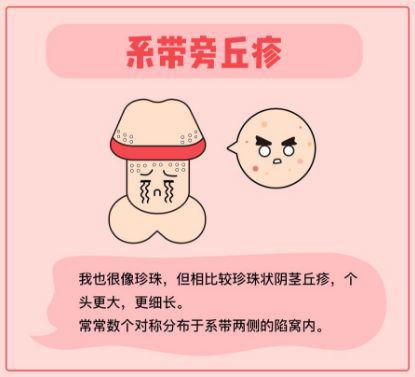 丁丁上有小疙瘩？这是性病吗...