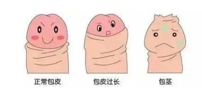 男性割完包皮后，身体会出现哪些变化