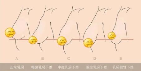 女生的胸到底有多少种形状