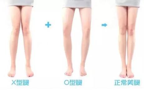 女生的双腿合不拢就意味着有性生活?别想多了……