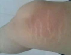 为啥女生的小腹上，都有一条褐色的缝