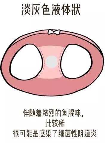 女孩子内裤总是湿哒哒 下面水太多也是一种烦恼！