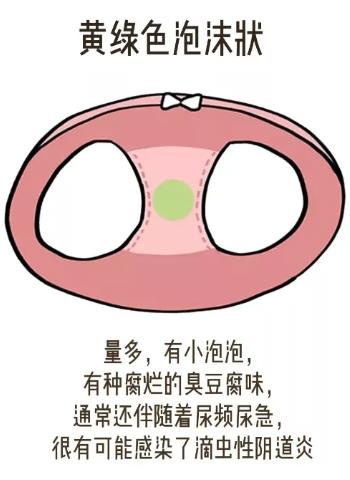 女孩子内裤总是湿哒哒 下面水太多也是一种烦恼！