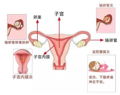 女孩子内裤总是湿哒哒 下面水太多也是一种烦恼!