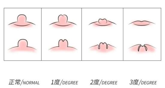 女友难以启齿的秘密：我没有乳头……