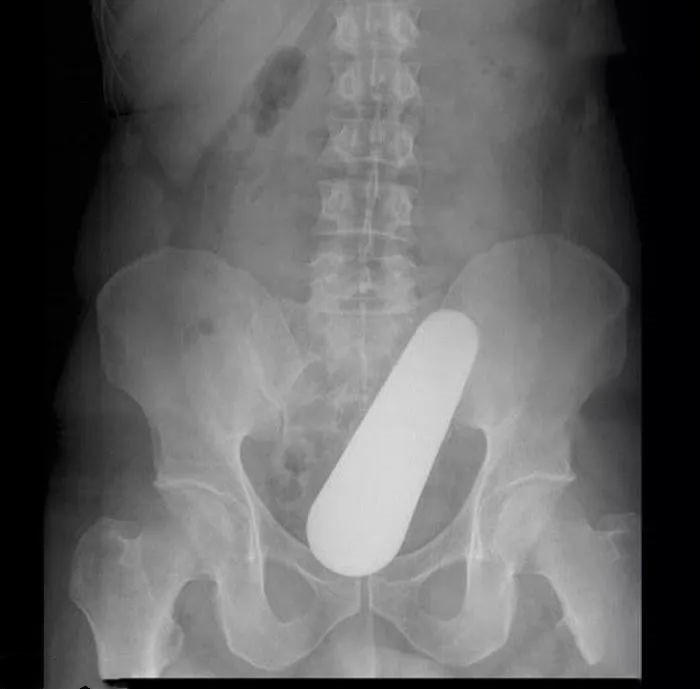 下体被日用品卡住怎么自救