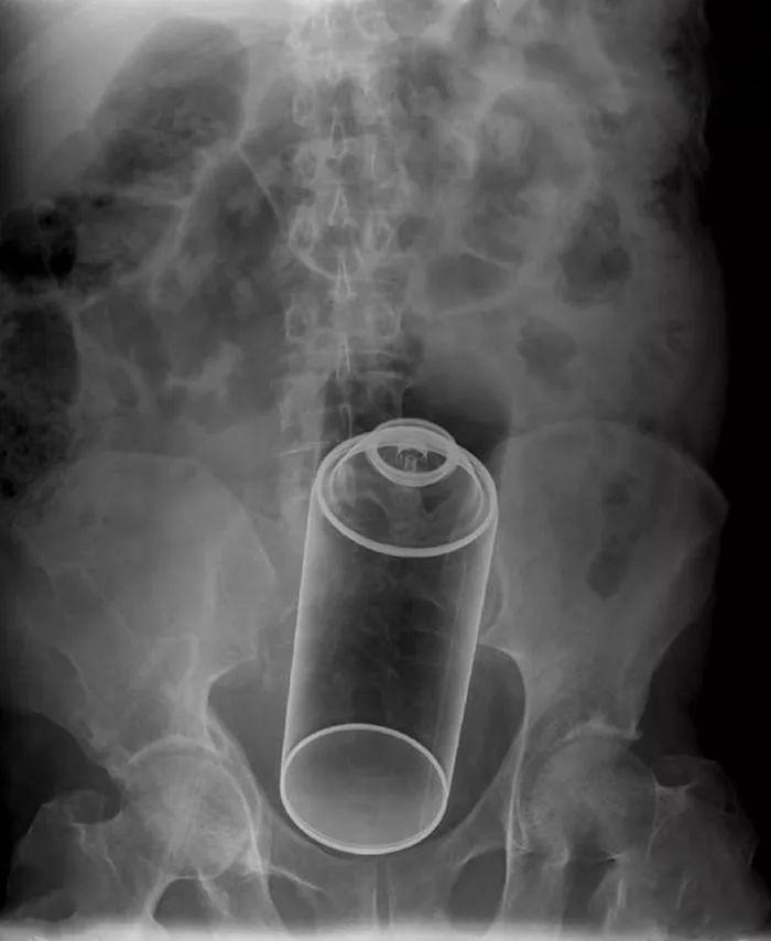 下体被日用品卡住怎么自救