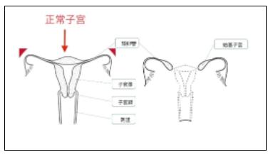 我没有子宫也没有阴道，是传说中的石女