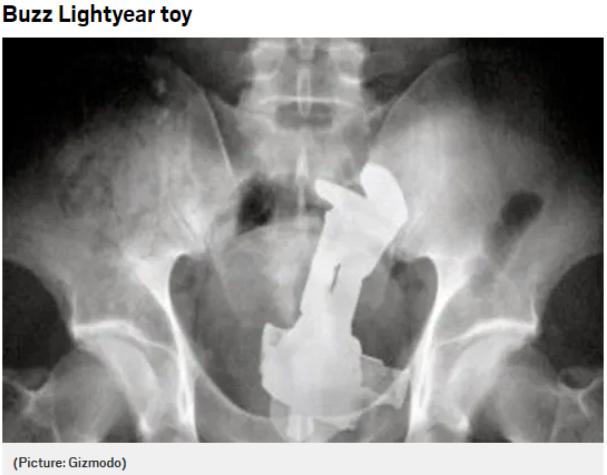 人们都在菊花里塞了什么东西？就挺离谱的