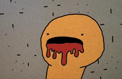 同房过程中出血，是太激烈了吗