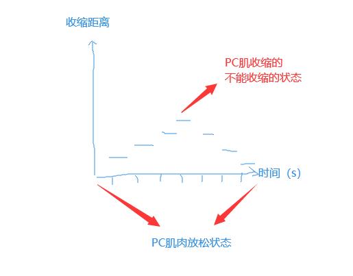 如何改善男人勃起硬度?试试PC肌、提肛、凯格尔运动