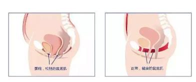 同房越频繁下面越松？真相其实是......