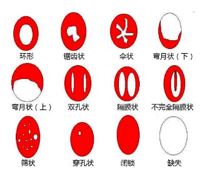 卫生棉条是什么？卫生棉条如何使用