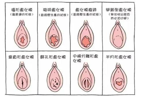 处女可以用卫生棉条吗？用棉条会不会不舒服？