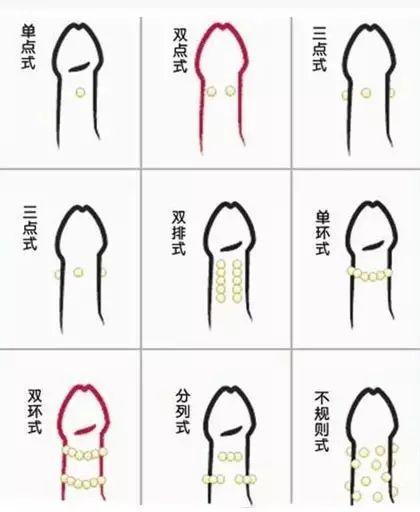 丁丁入珠这件事，真的有用吗