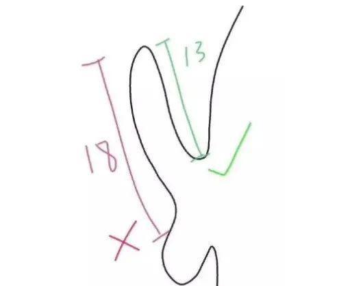 丁丁长时间不用，会「缩水」变小吗