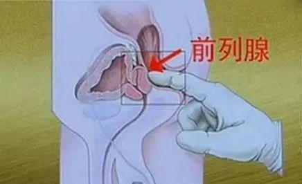 在男友床上发现人体润滑剂，结果……