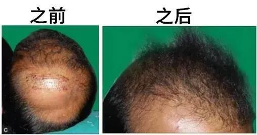 私处毛毛居然还能这么用