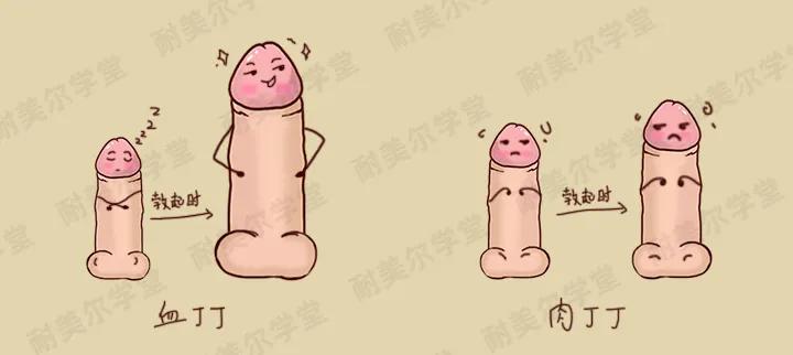 血丁丁和肉丁丁,你的男朋友是什么类型