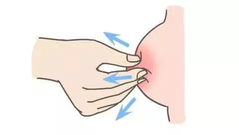 女生乳头凹陷是怎么回事