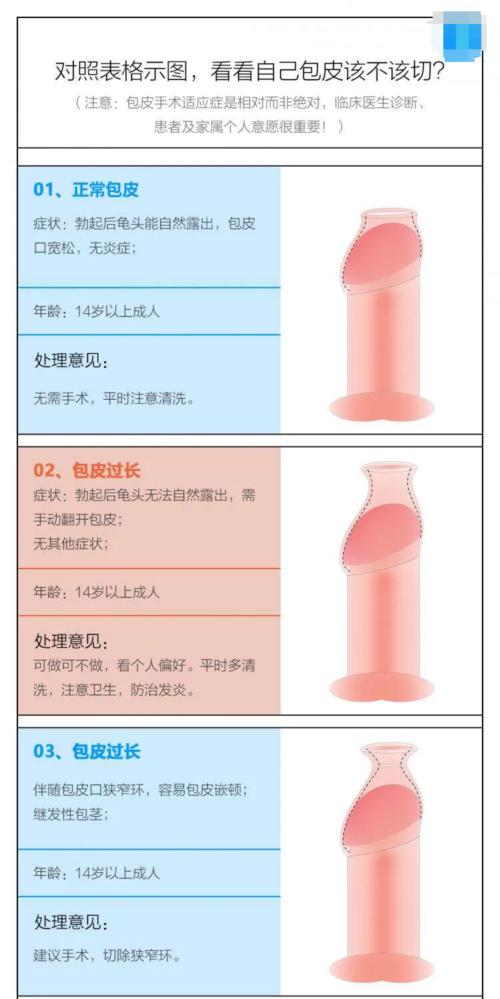 如何判断包皮是否过长，包皮手术最全术前指南