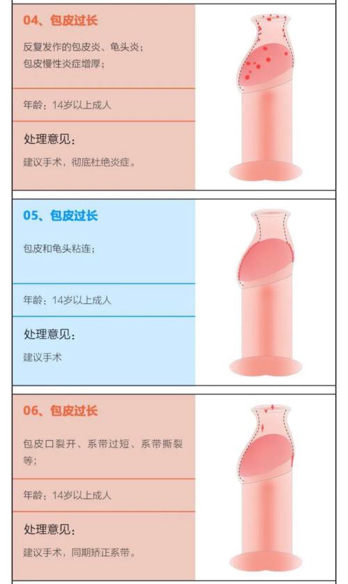 如何判断包皮是否过长，包皮手术最全术前指南