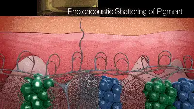 私密医美真的能让私处回春吗