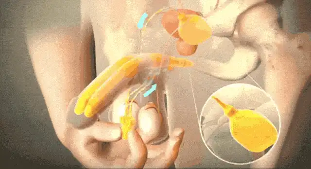 丁丁又软又短怎么办？这个神器让你随心所欲