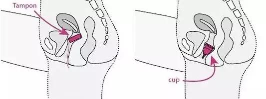 如何告别姨妈期黏腻的难受感，清爽度过姨妈期