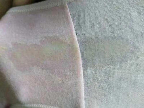 羊水漏出来的真实图片