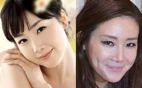 韩国明星整容失败：韩国整容失败的女明星（图）
