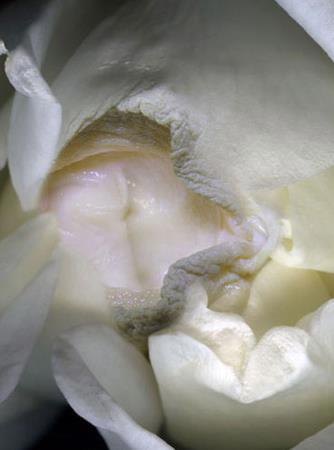 女人二十种外阴照片:女人外阴的形状照片与生理知识